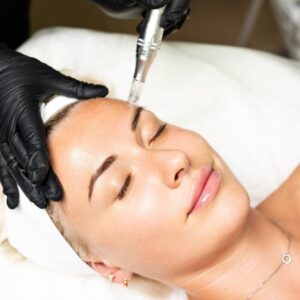 Glass Skin Microneedling Facial