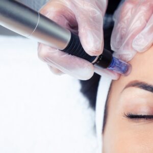 Glow Combo Dermaplane + Microneedling