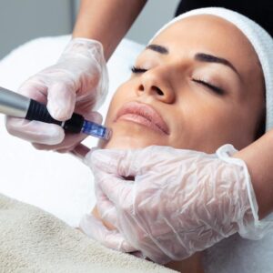 Hydrofacial + Microneedling